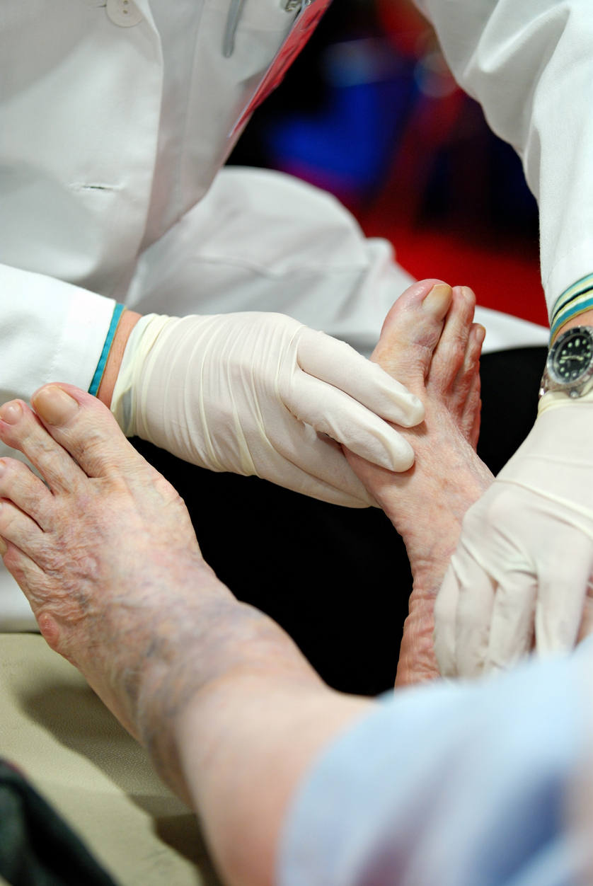 podologia zajmuje się leczeniem schorzeń stóp